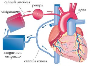 valvola aortica