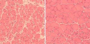 Cellule muscolari di topi anziani (a sinistra) e ringiovaniti (a destra) (fonte: Juan Carlos Izpisua, Belmonte Lab /Salk Institute) 