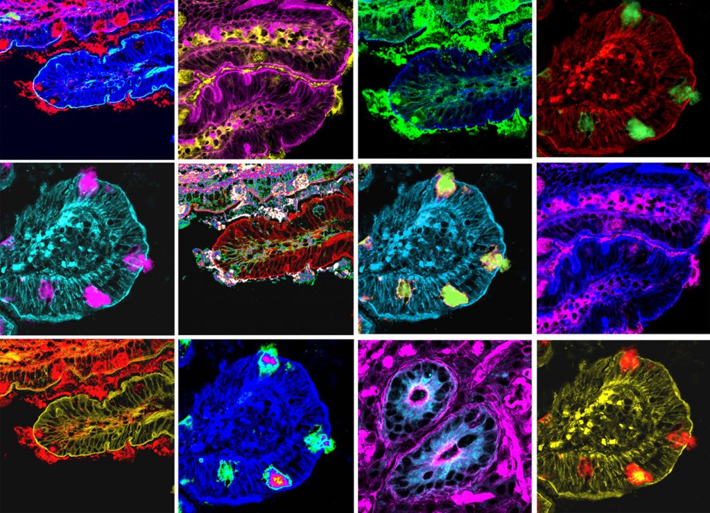 Villi intestinali - Confocale