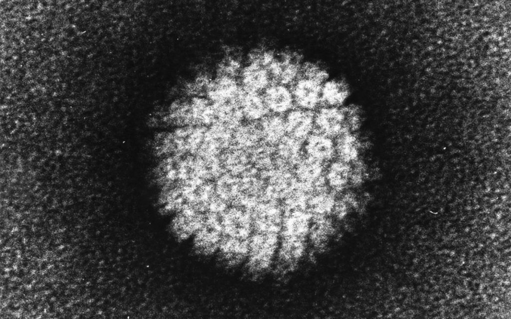 tumore papilloma virus tumori