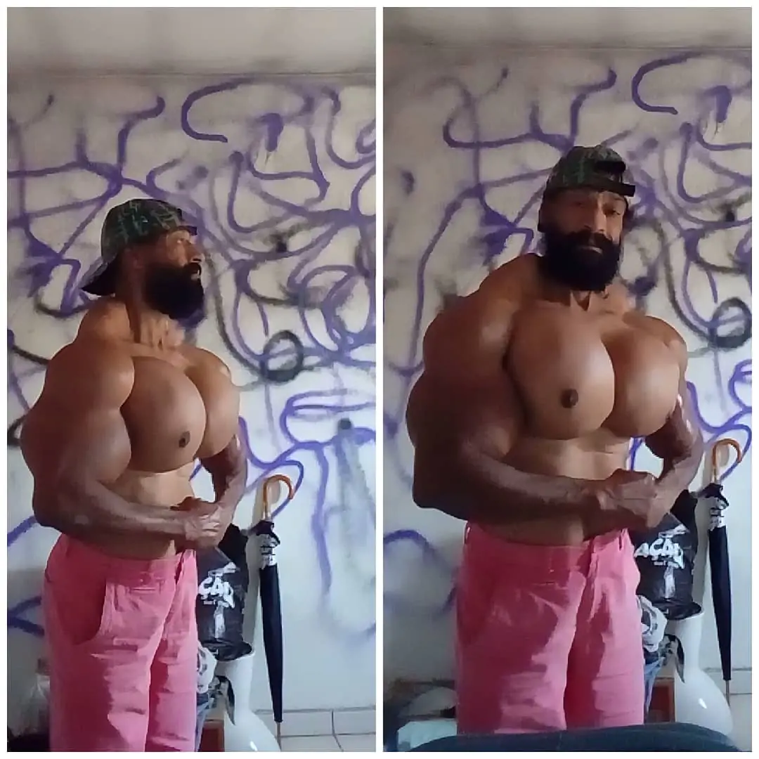 Bodybuilder russo rischia la vita per le sostanze iniettate sui