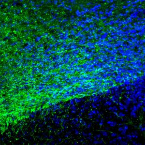 Sclerosi multipla nuova luce sul ruolo della microglia nella riparazione della mielina