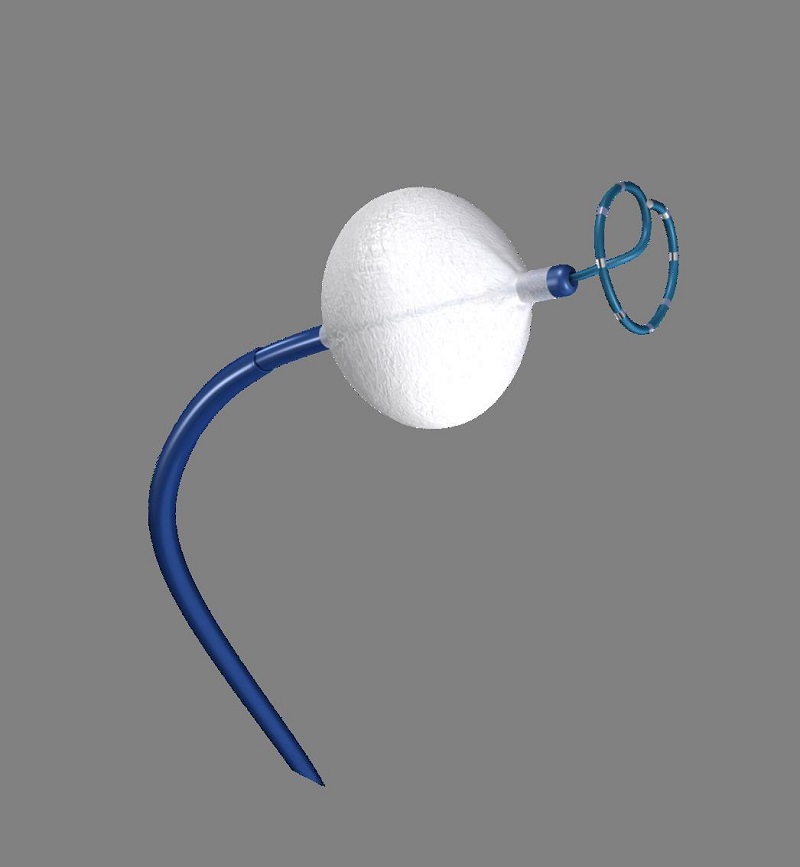 palloncino fibrillazione atriale