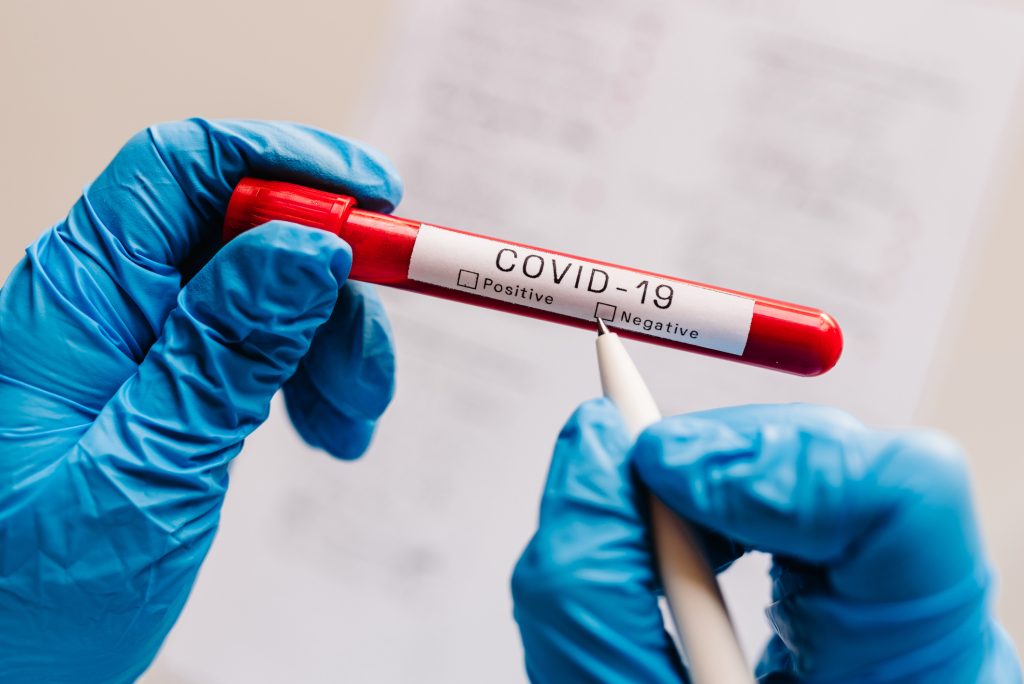 pandemia coronavirus covid