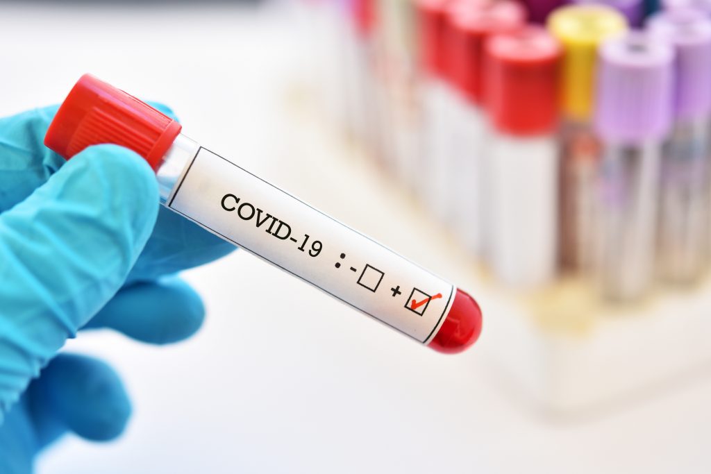 pandemia coronavirus covid