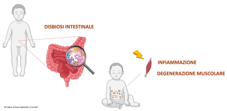 distrofia muscolare duchenne