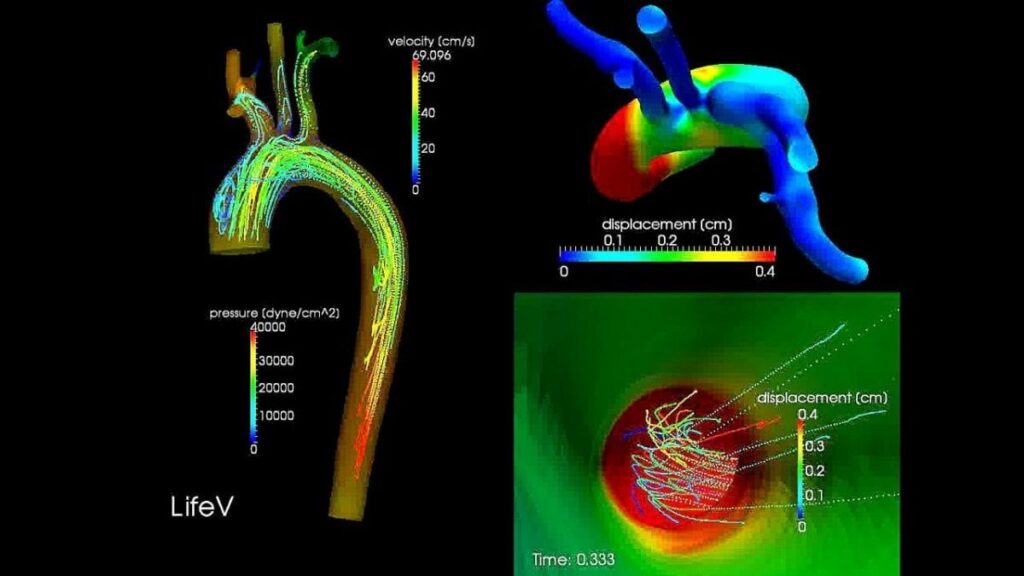 progetto iHeart - cuore digitale