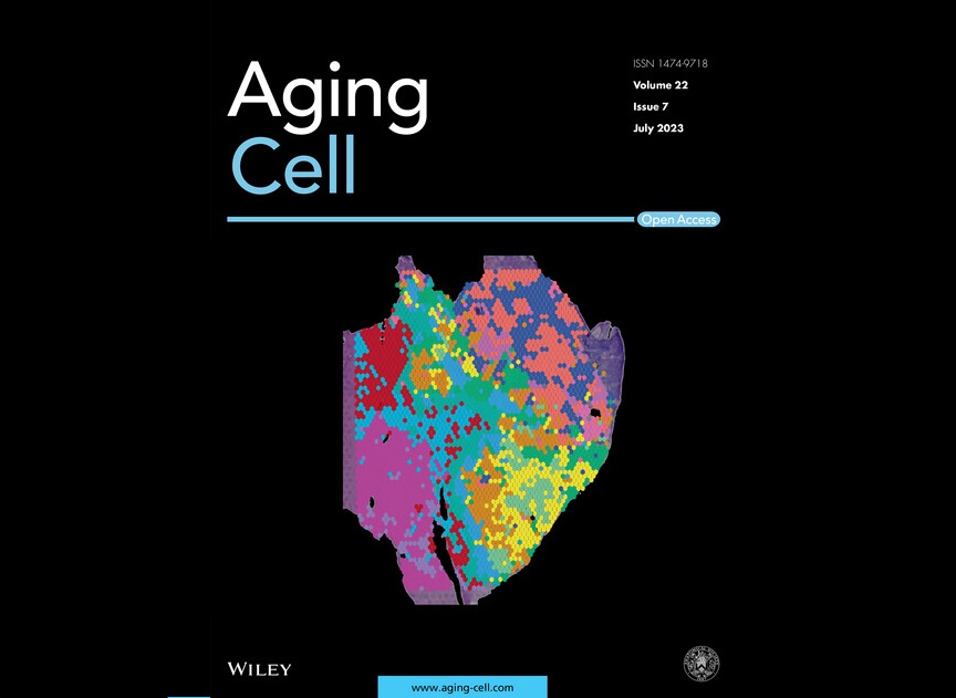 Metastasi colon retto cellule senescenti