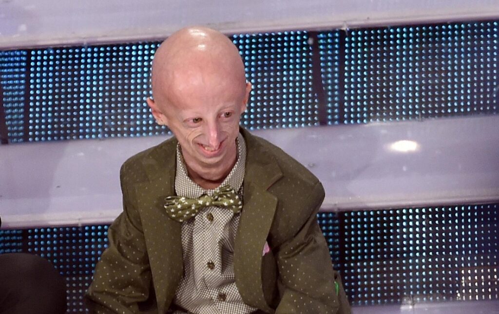 sammy basso progeria