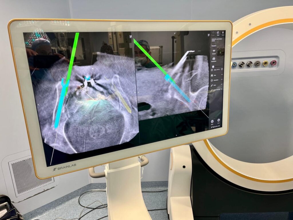 Robotica Spinale Neurochirurgica